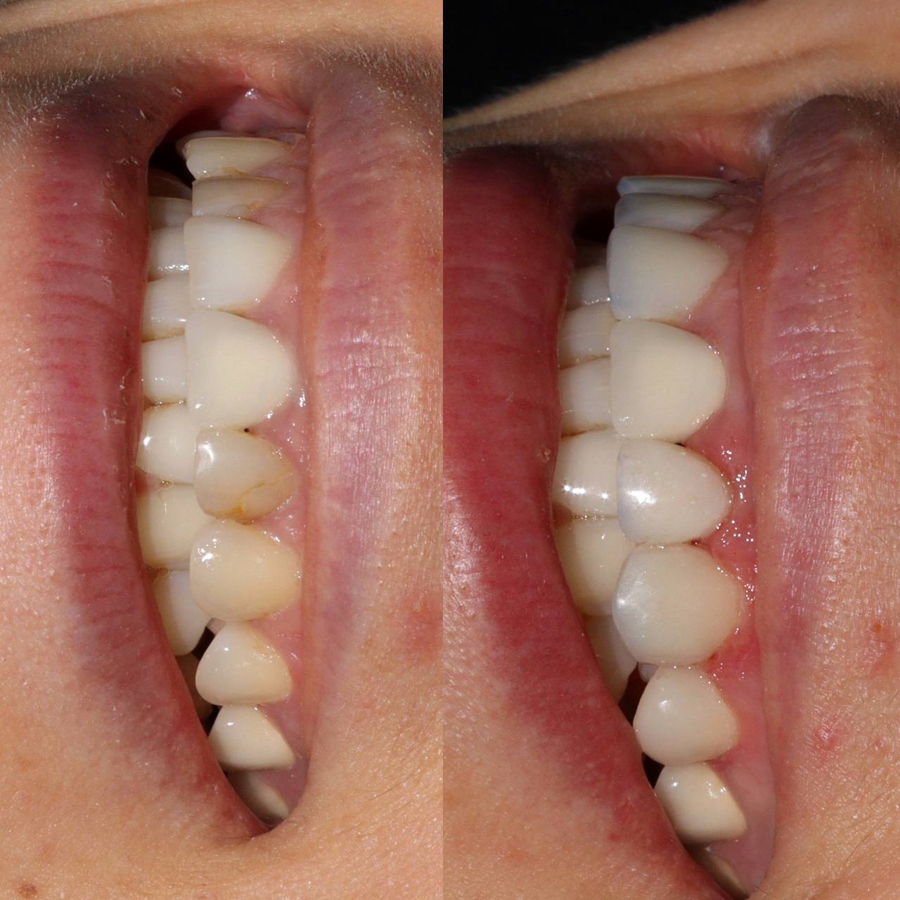 Галерея Angelina Dental 2