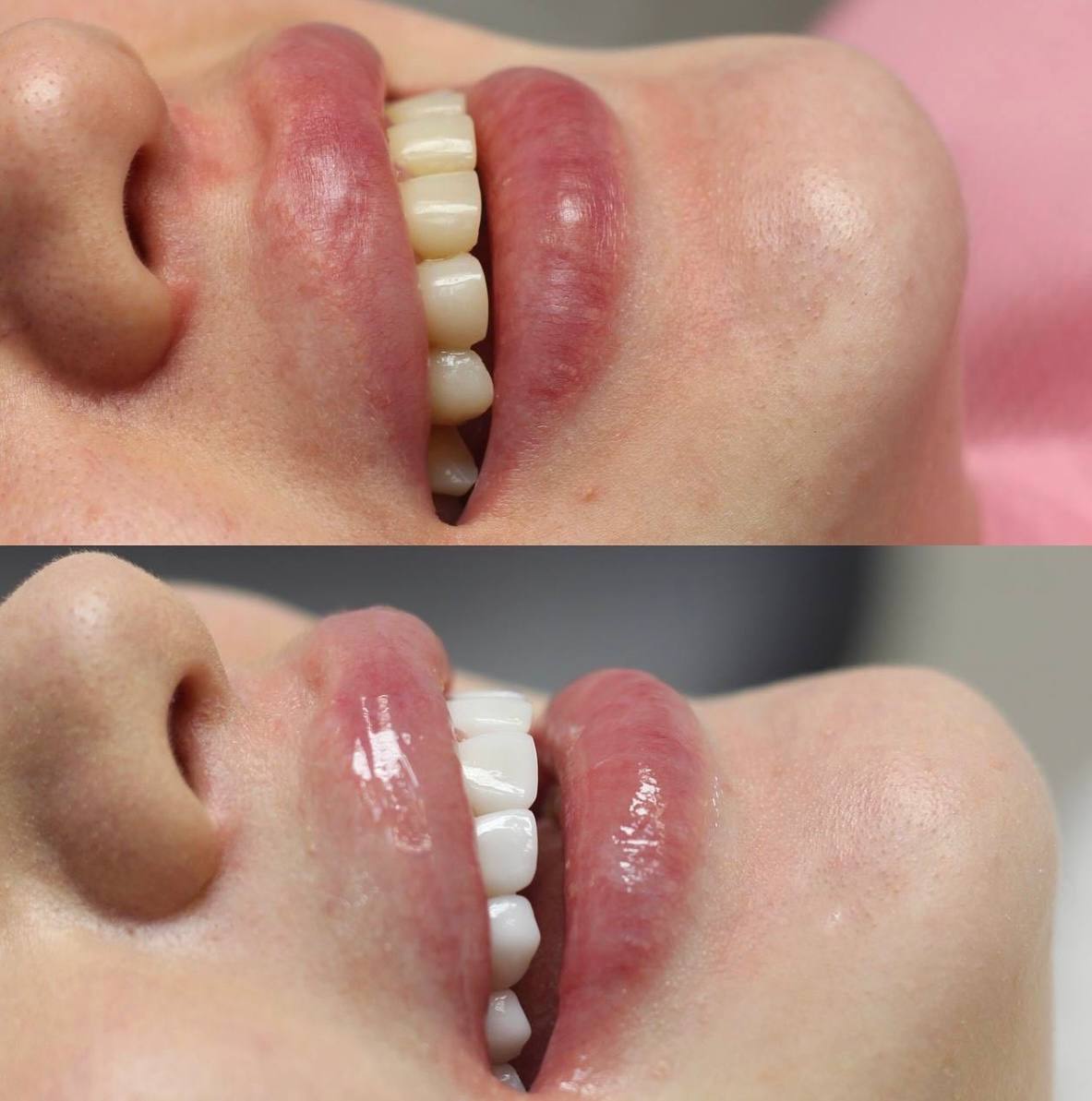 Галерея Angelina Dental 3