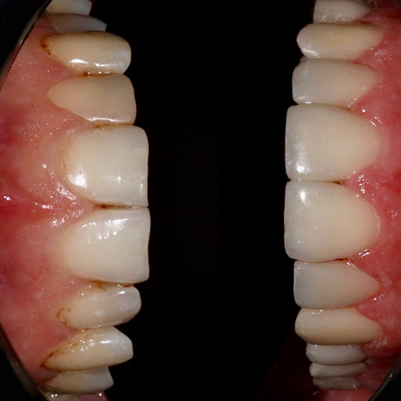 Галерея Angelina Dental 4