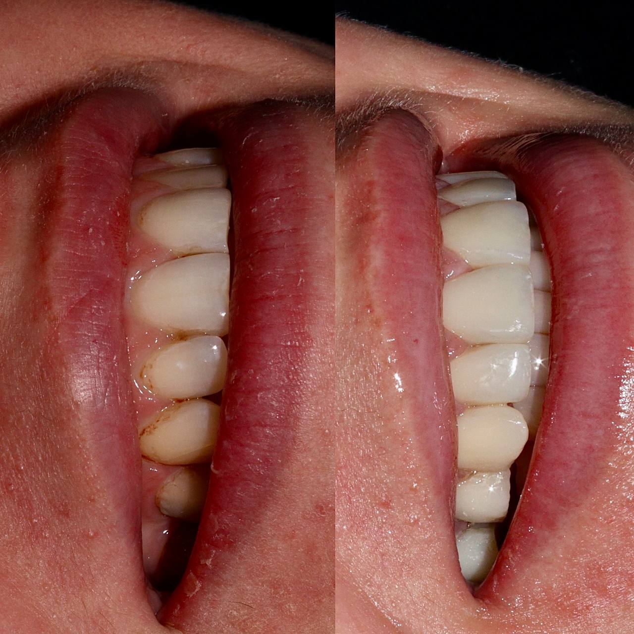 Галерея Angelina Dental 5