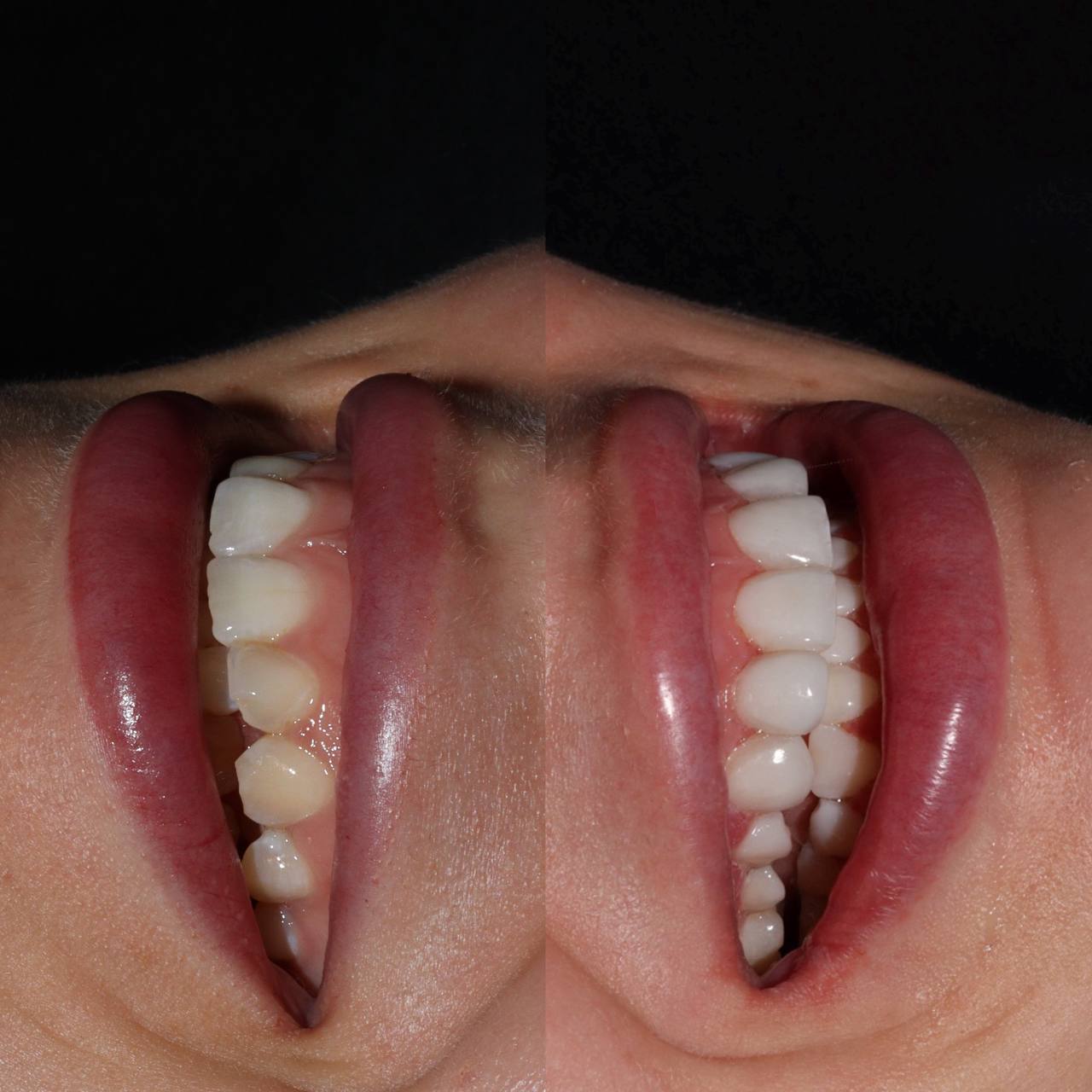 Галерея Angelina Dental 6