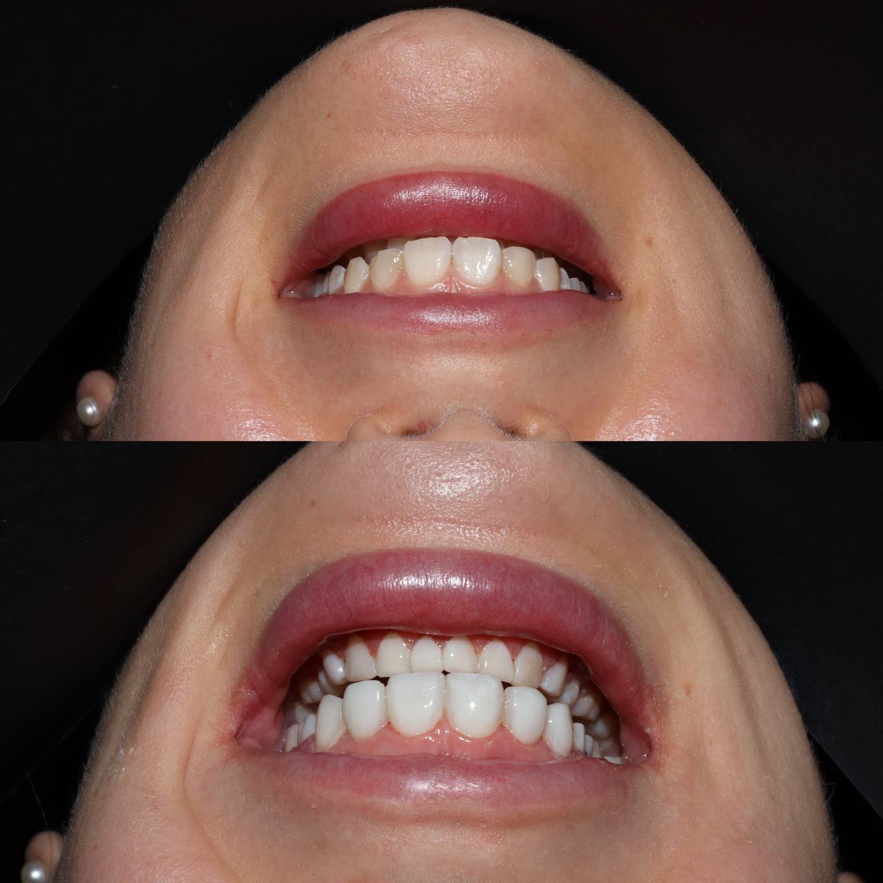 Галерея Angelina Dental 7