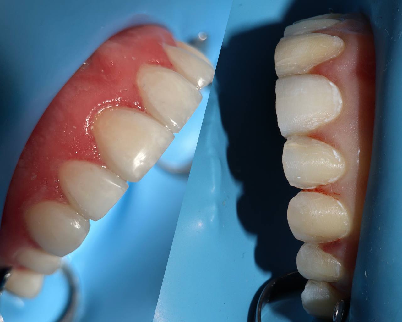Галерея Angelina Dental 8
