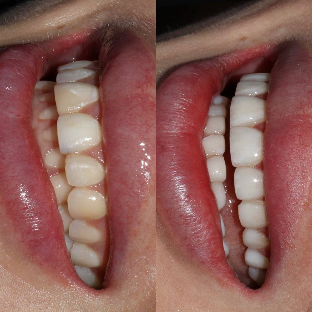 Галерея Angelina Dental 9